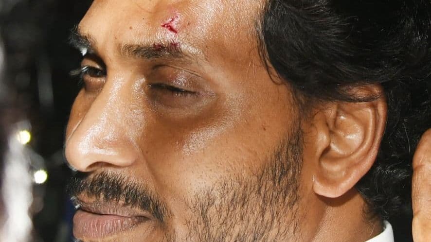 Breaking: Stone Attack Injures AP CM Jagan Mohan Reddy During Bus Yatra in Vijayawada