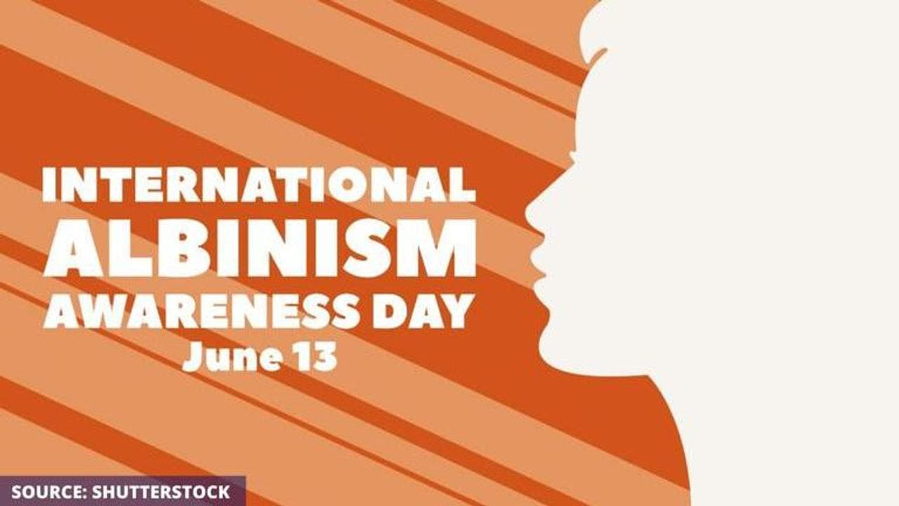 International albinism awareness day 2020