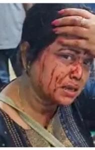 Smriti Irani Reacts to Attack on BJP Leader Saraswati Sarkar by TMC Goons